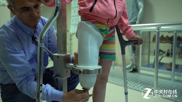 殘疾兒童佩戴義肢腿套