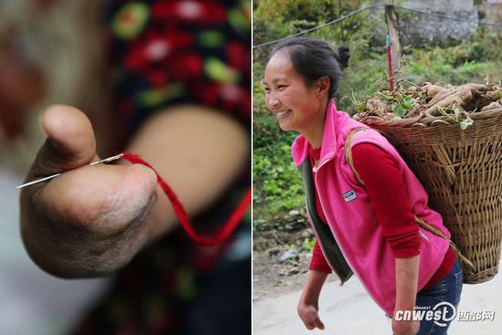 85后殘疾女用獨指彈出生活強音