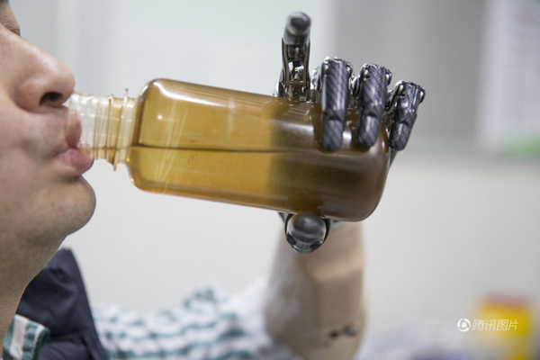 殘疾人裝上智能仿生手 能用電腦刮胡子