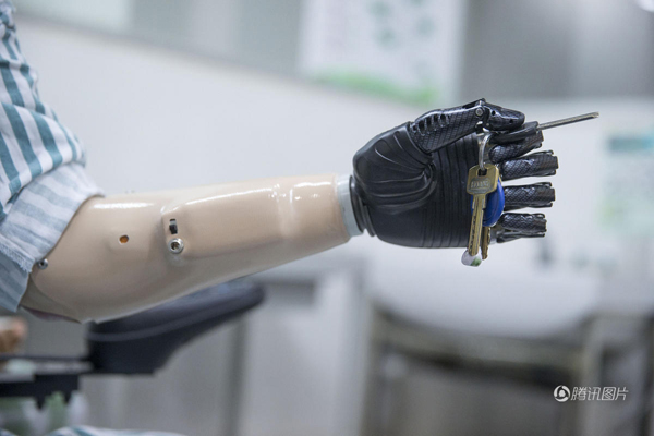 殘疾人裝上智能仿生手 能用電腦刮胡子